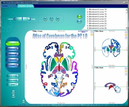 Atlas of Cerebrum for the PC 1.0