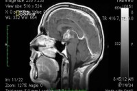 ���������� ��� ����������. �������� ��������� / Is it Real. Miracle Cures (2009) HDTVRip